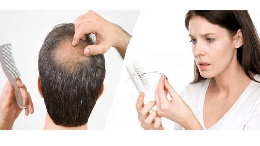 &nbsp;بهترین راهکارها برای جلوگیری از ریزش مو در هر نوع مو