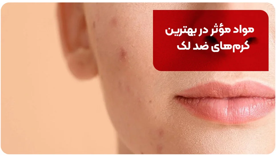 مواد مؤثر در بهترین کرم&zwnj;های ضد لک
