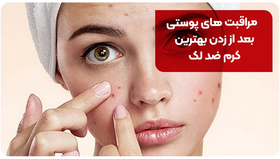 مراقبت&zwnj;های پوستی بعد از زدن بهترین کرم ضد لک