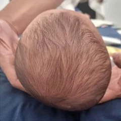 بزرگ بودن سر نوزاد