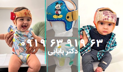 بزرگ بودن سر نوزاد